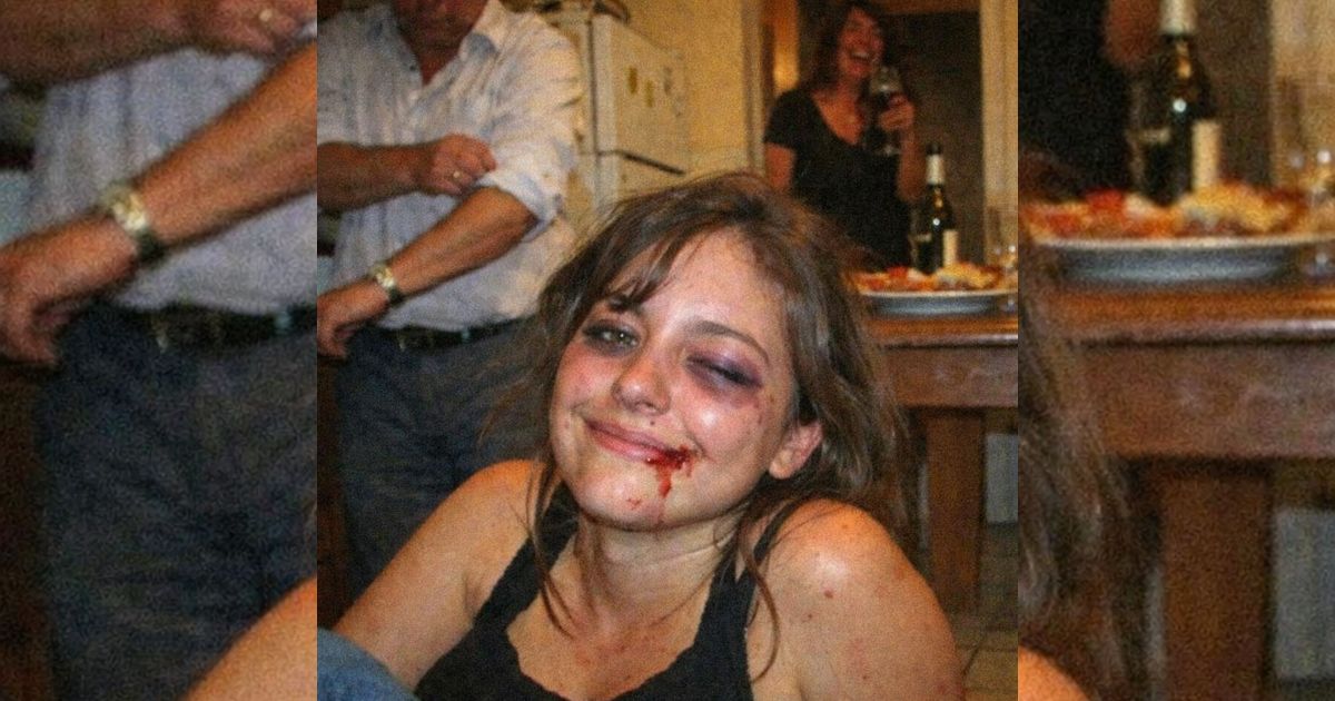 Mio padre mi ha rotto la mandibola per una risposta… e io ho sorriso: quella sera, davanti a tutti, è iniziata la sua caduta